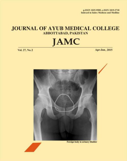 Foreign body in urinary bladder